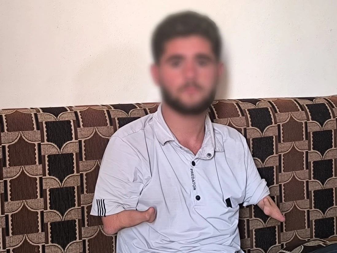 تشوهٌ خلقي منعهُ من العمل